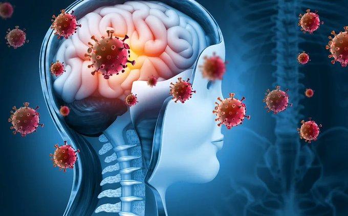 Sinaloa en alerta por casos de meningitis aséptica en Durango Sinaloa en alerta por casos de meningitis aséptica en Durango