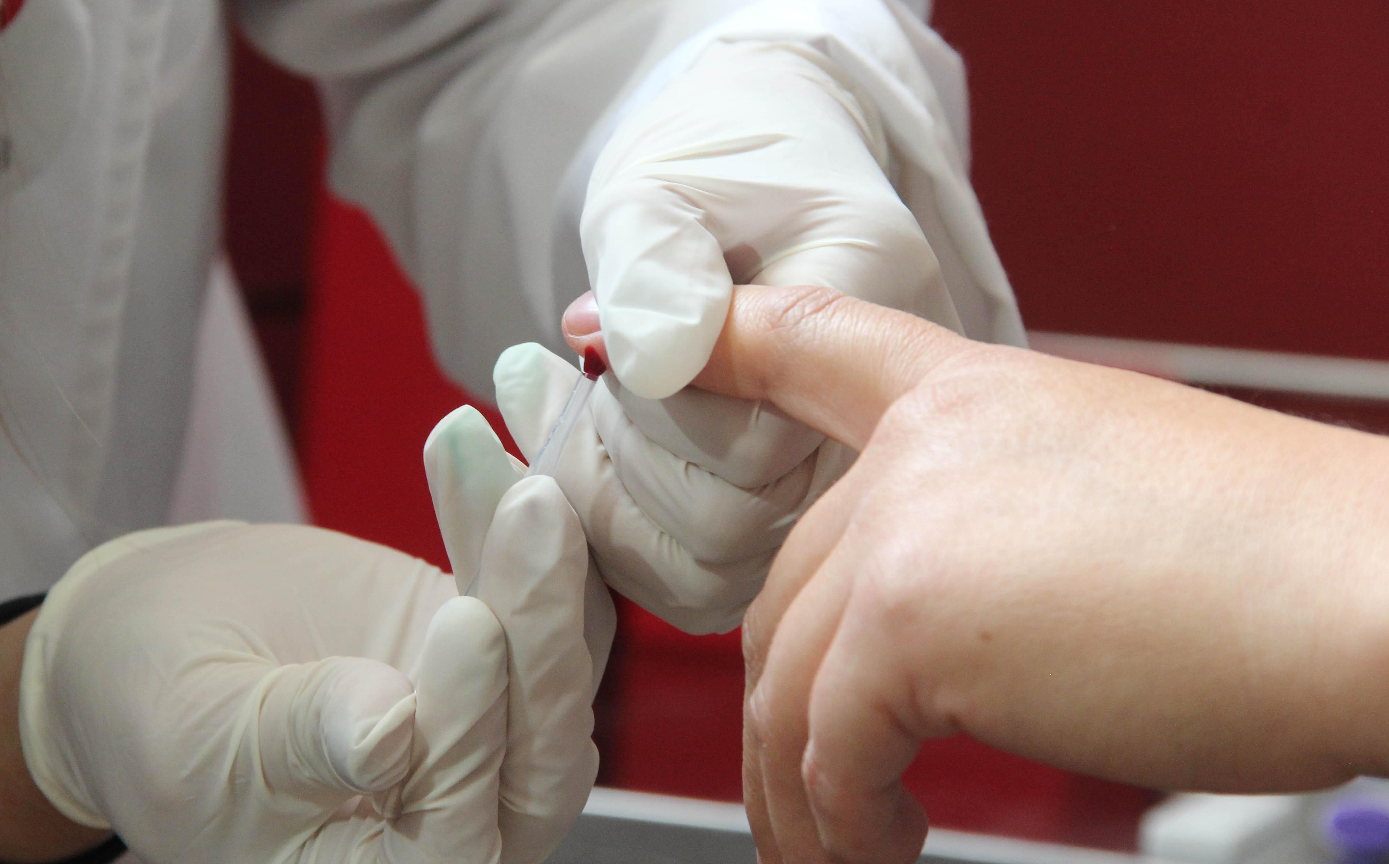 SSH fortalece acciones de prevención contra VIH/SIDA