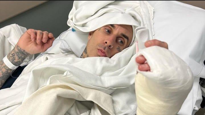 Travis Barker sube foto de la operación en su dedo Travis Barker sube foto de la operación en su dedo