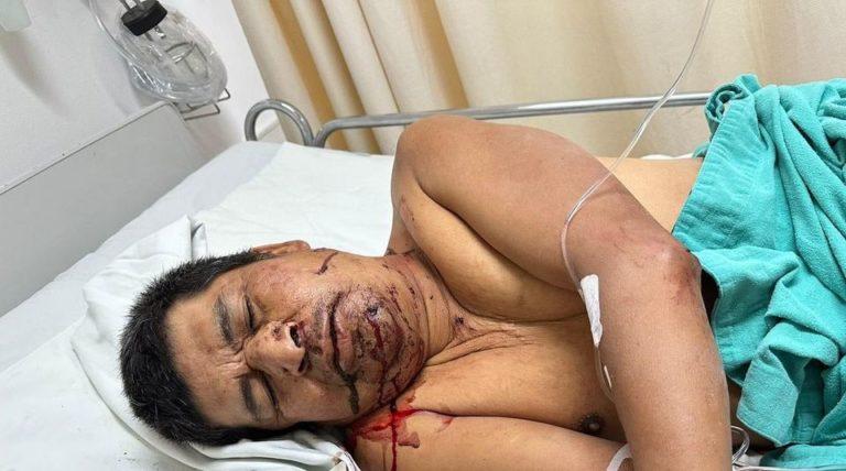Hallaron a hombre severamente golpeado; se busca a sus familiares Hallaron a hombre severamente golpeado; se busca a sus familiares