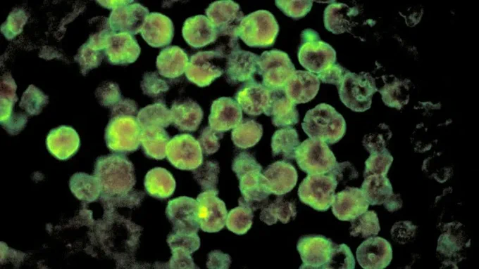Bacteria mortal deja 3 muertos en EU Bacteria mortal deja 3 muertos en EU