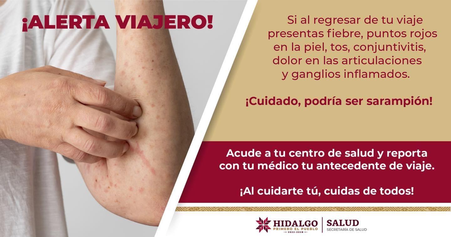 Extremar precauciones para evitar sarampión, Influenza y COVID-19