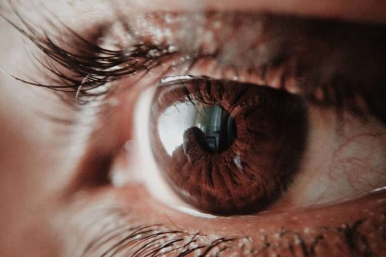 Glaucoma, segunda causa de ceguera a nivel mundial