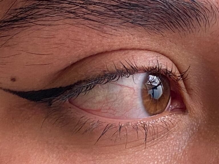 IMSS emite recomendaciones para evitar la conjuntivitis